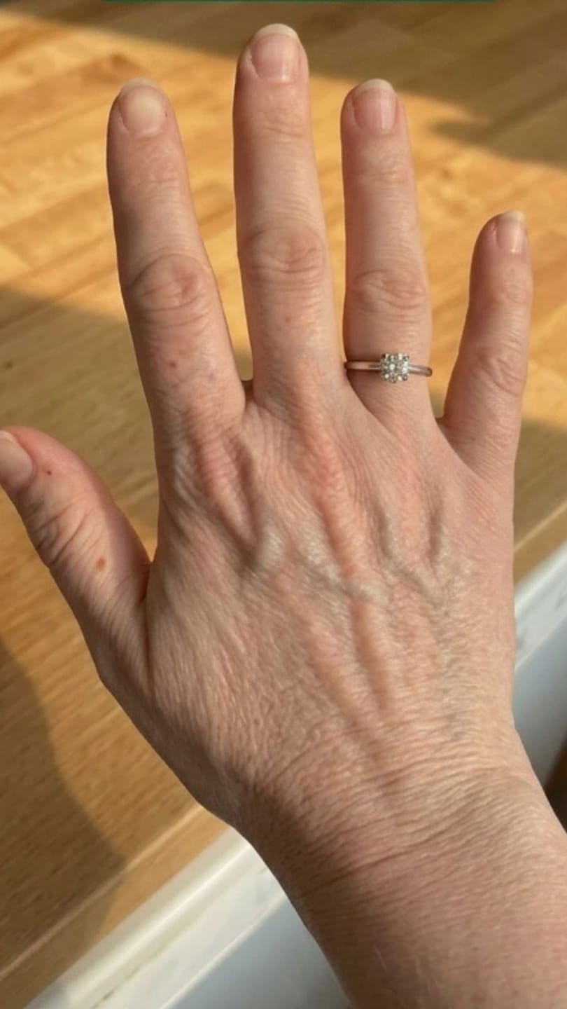 Customer photo review of Atelier Novar – Drainage Lymphatique