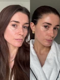 Customer photo review of Rétinal Shot