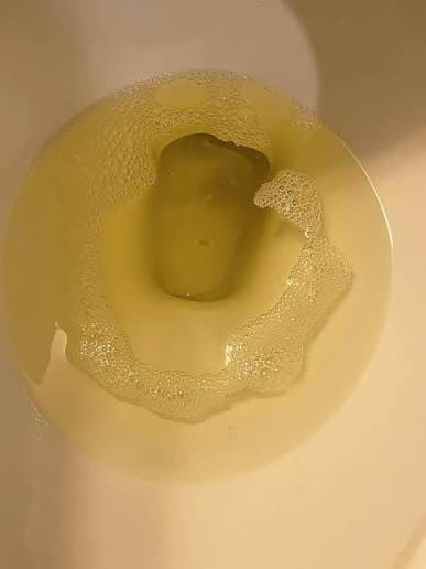 Customer photo review of Astaxantina 12 mg