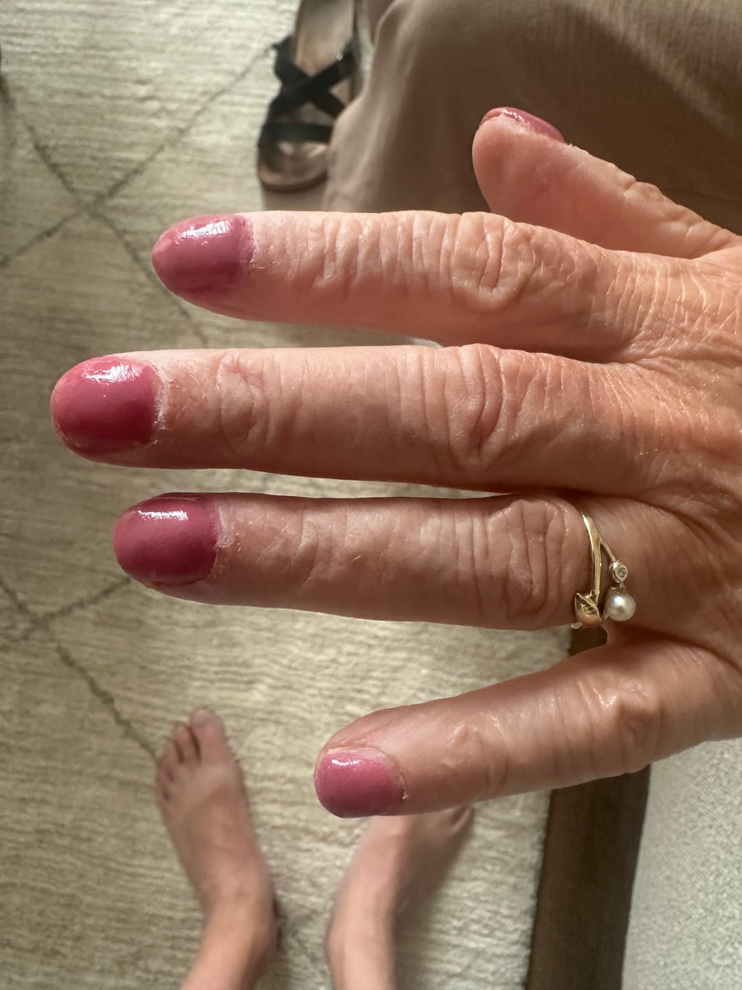 Customer photo review of Peel Off Base Coat