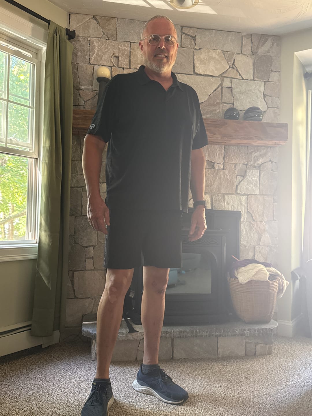 Customer photo review of Shipping Protection