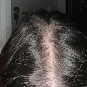 Customer photo review of Controllo Olio Shampoo Antiforfora Delicato con Selenium