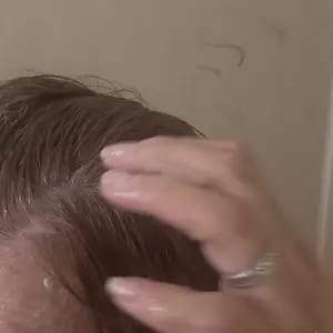 Customer photo review of Controllo Olio Shampoo Antiforfora Delicato con Selenium