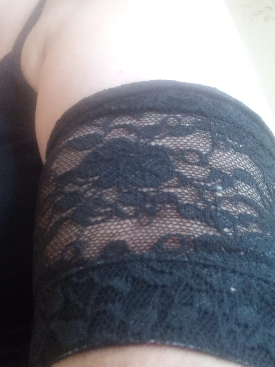 Customer photo review of Lace Armbands to Protect CGM and Insulin Pump - Dia-Band SPACY LACY