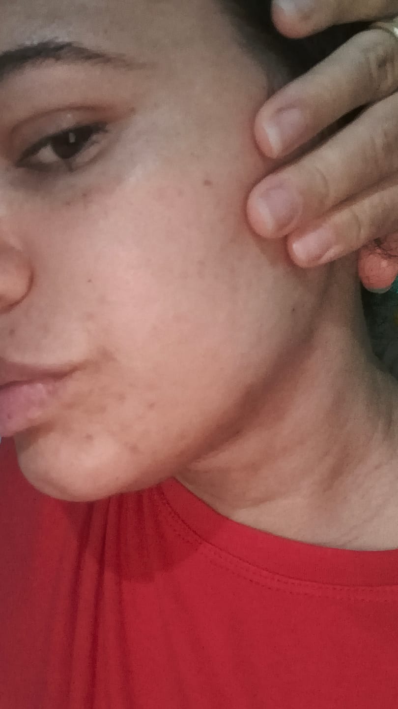 Customer photo review of Kit Clareamento Total + 1 Firmador de Brinde