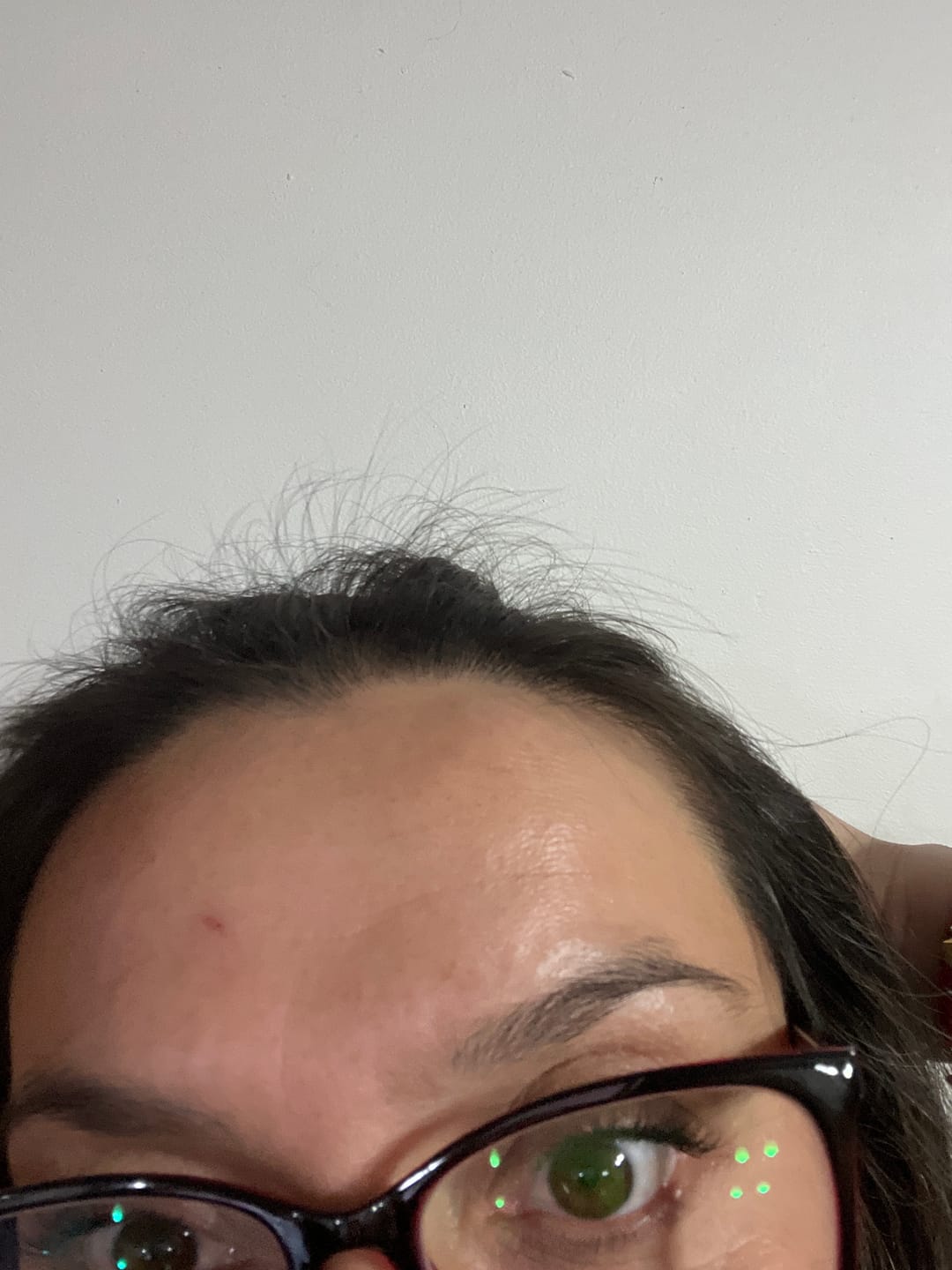 Customer photo review of Pack Anticaída de Cabello para 1 Mes