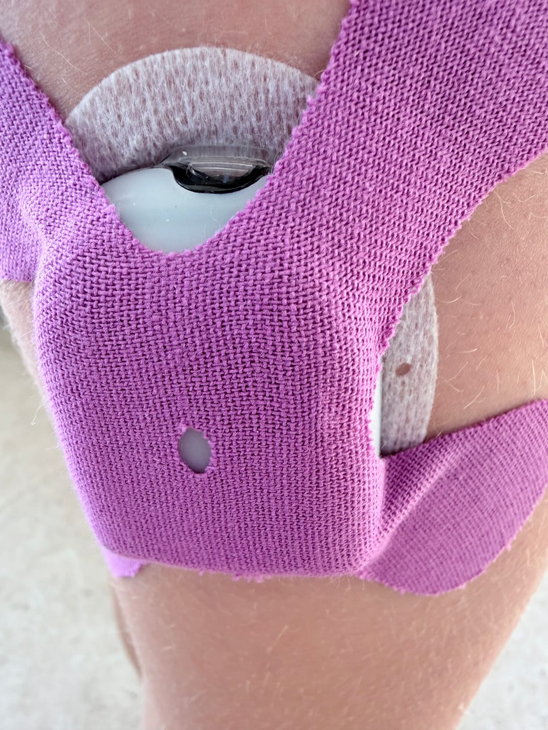Customer photo review of X- Patch תפזורת 20 יח׳