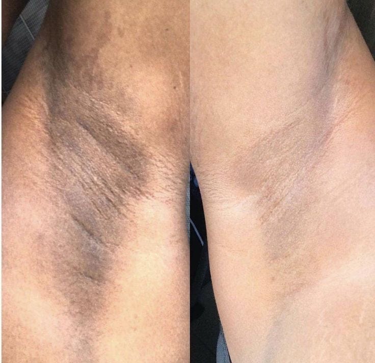 Customer photo review of Rétinal Shot
