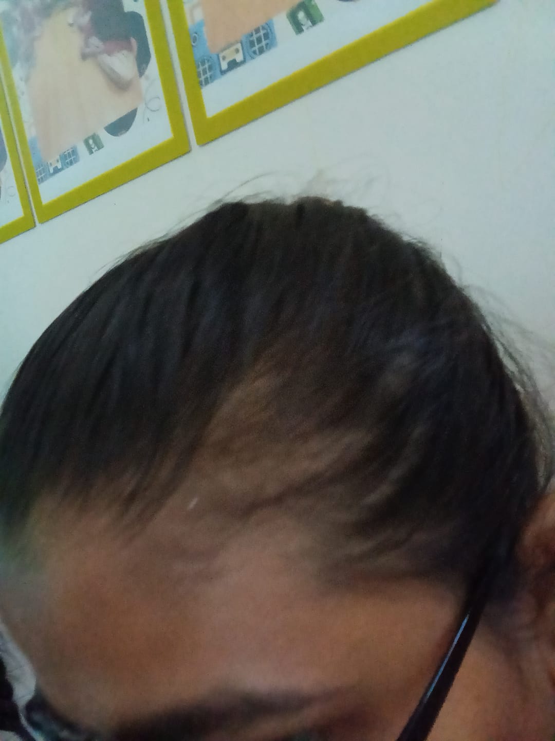 Customer photo review of Onion & Curry Leaf Shampoo With Conditioner