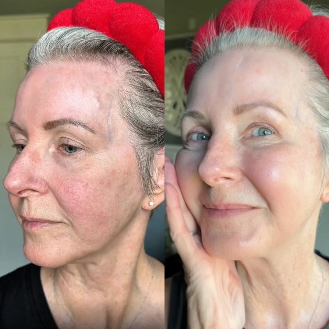 Customer photo review of Rétinal Shot