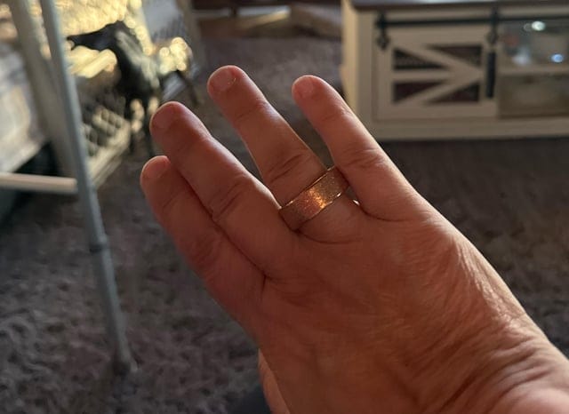 Customer photo review of Aura Ring