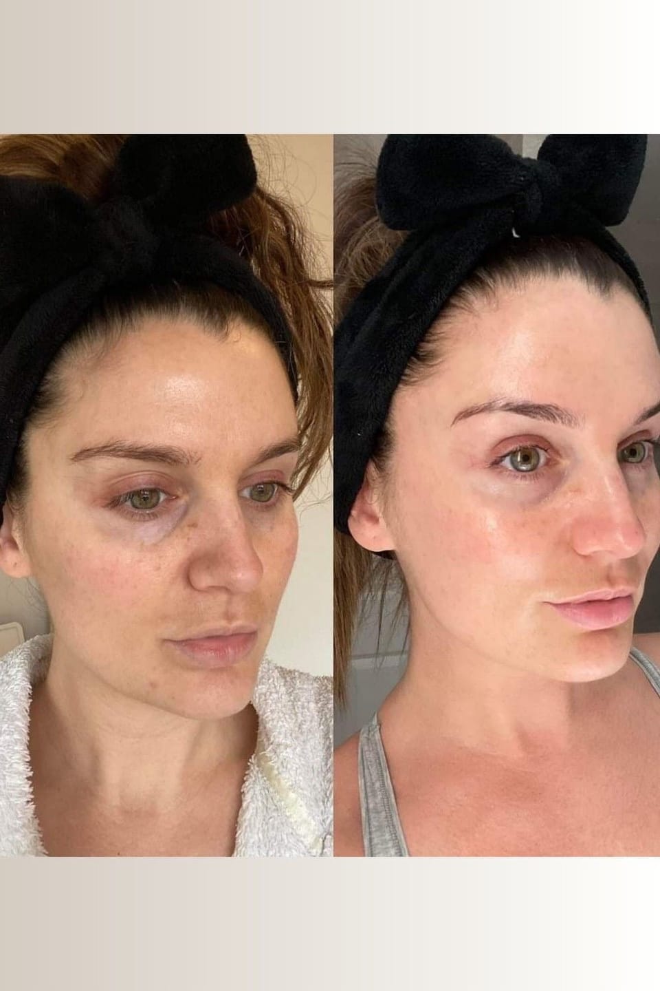 Customer photo review of Rétinal Shot