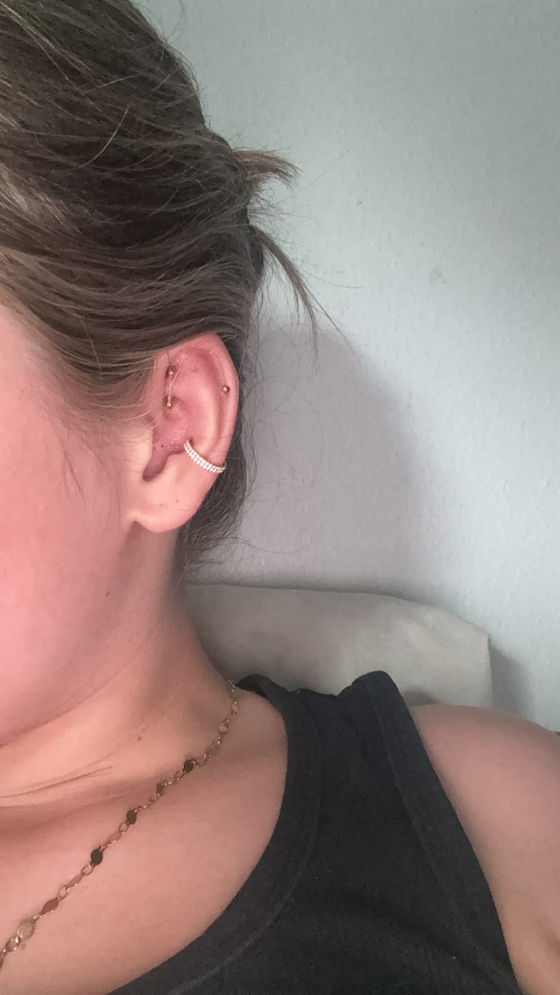 Customer photo review of Double Conch Piercing | Titan