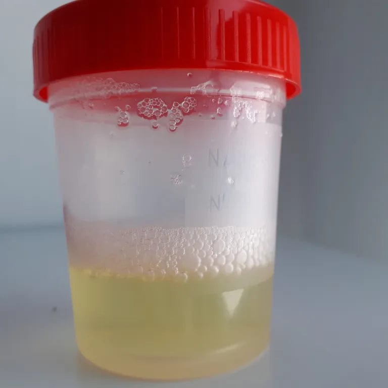 Customer photo review of Astaxantina 12 mg