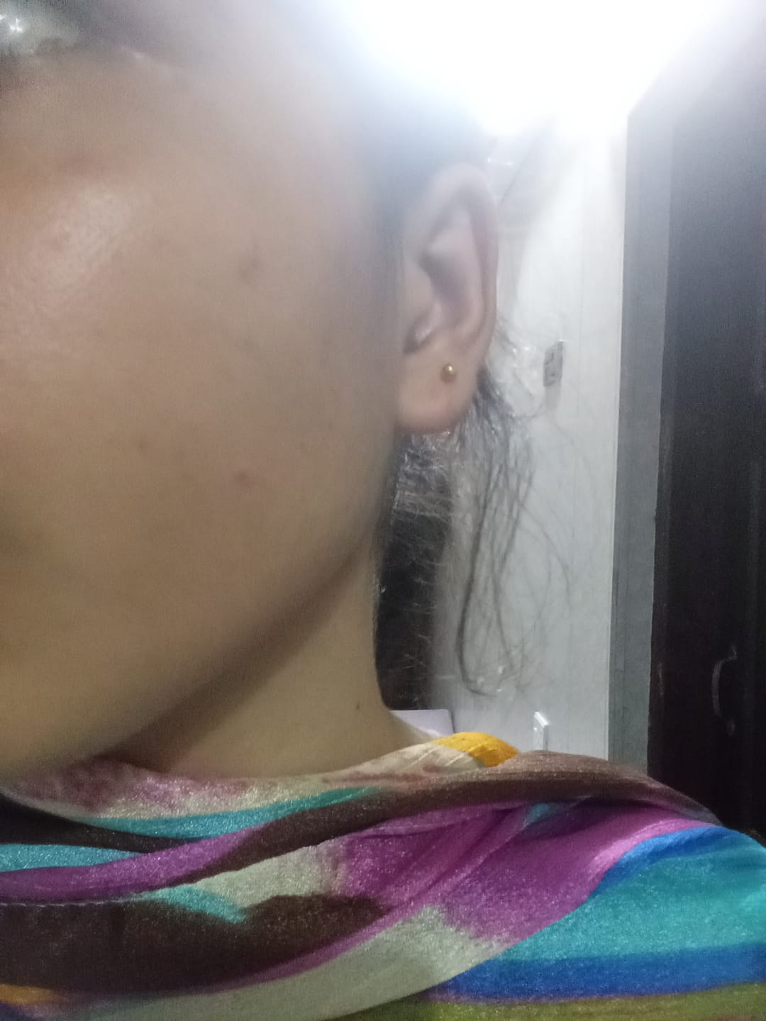 Customer photo review of Dermive Oil Free Moisturizer