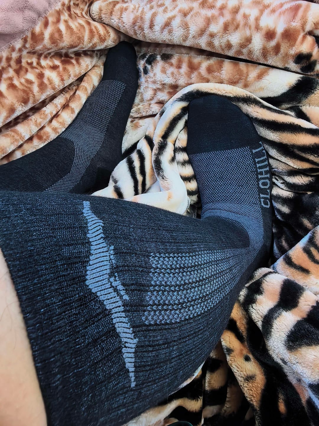 Customer photo review of Alpaca Compression Socks