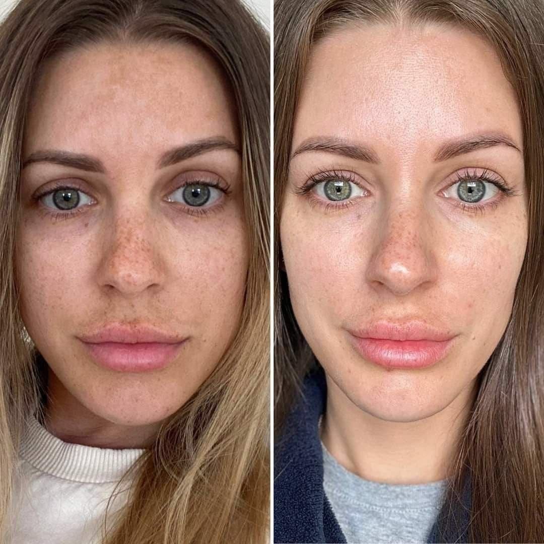 Customer photo review of Rétinal Shot