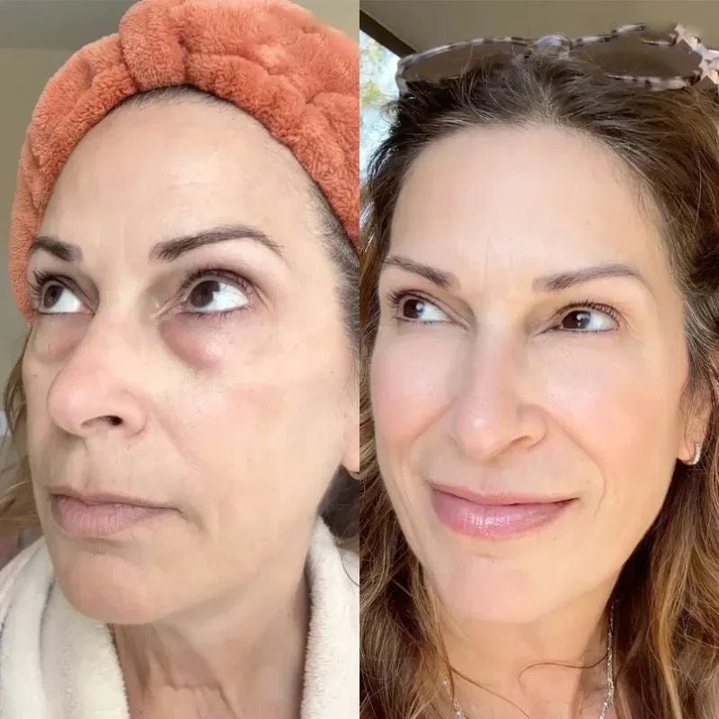 Customer photo review of Rétinal Shot