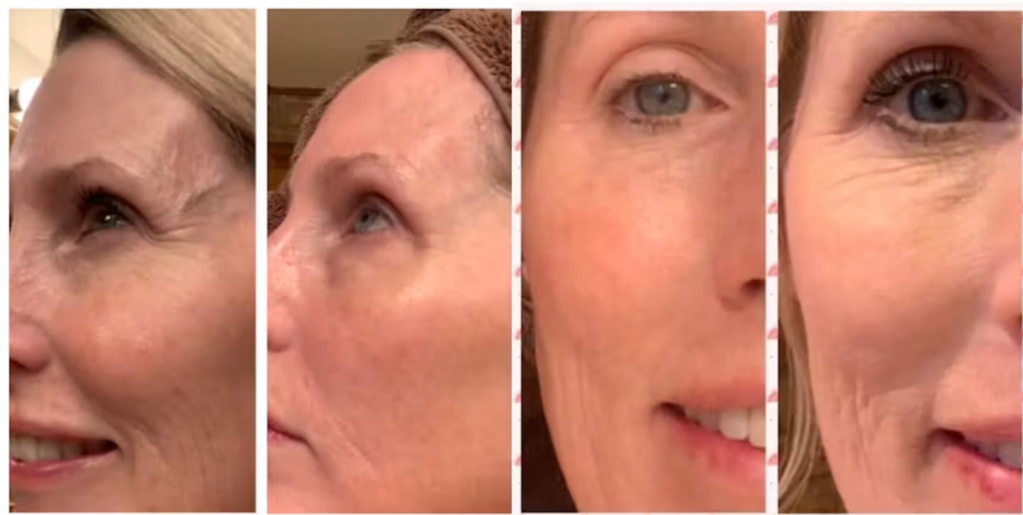 Customer photo review of Collagen Plus 30 Sticks Vorbestellung - Auslieferung 02.09.26