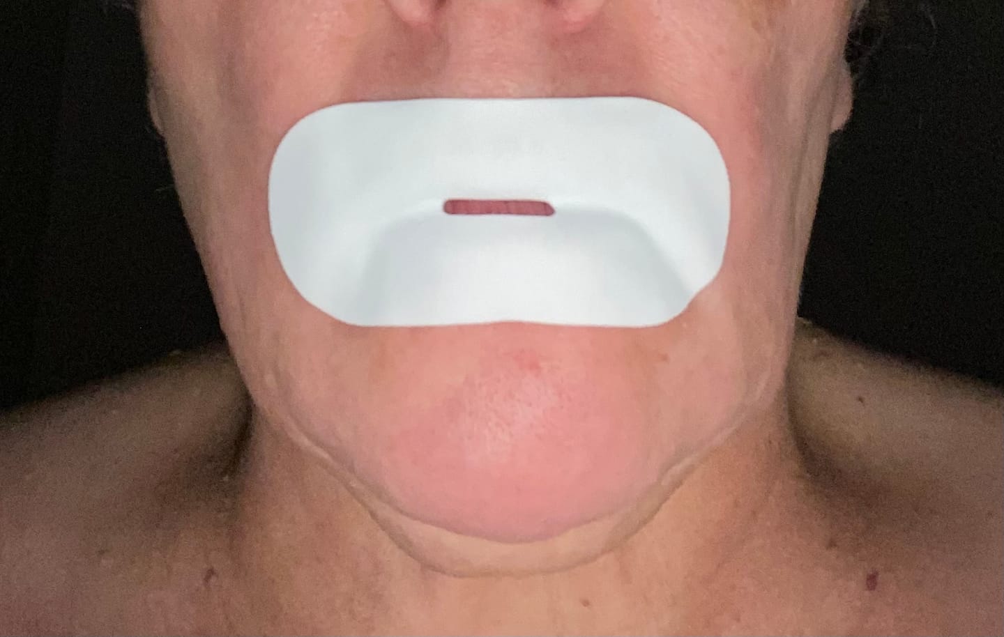 Customer photo review of Nuku Sleep Mouth Tape