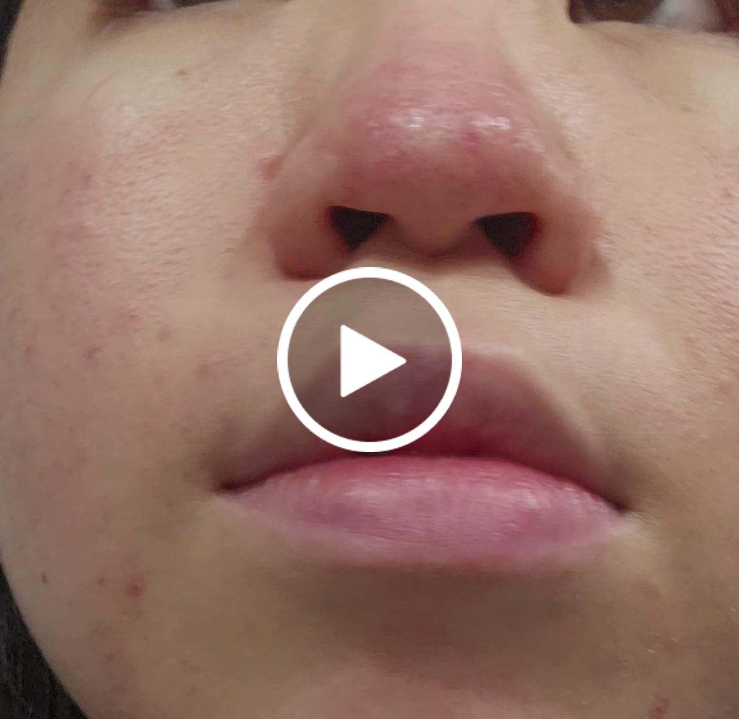 Customer video review of Blue EGF Calming Mist