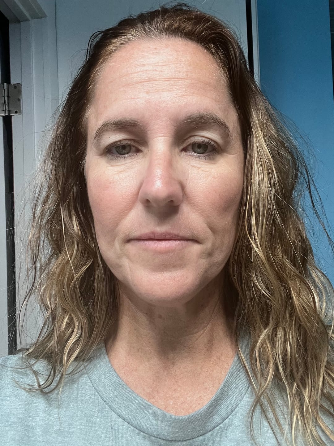 Customer photo review of The Complete System for Mature Women’s Skin