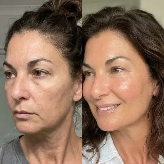Customer photo review of Rétinal Shot