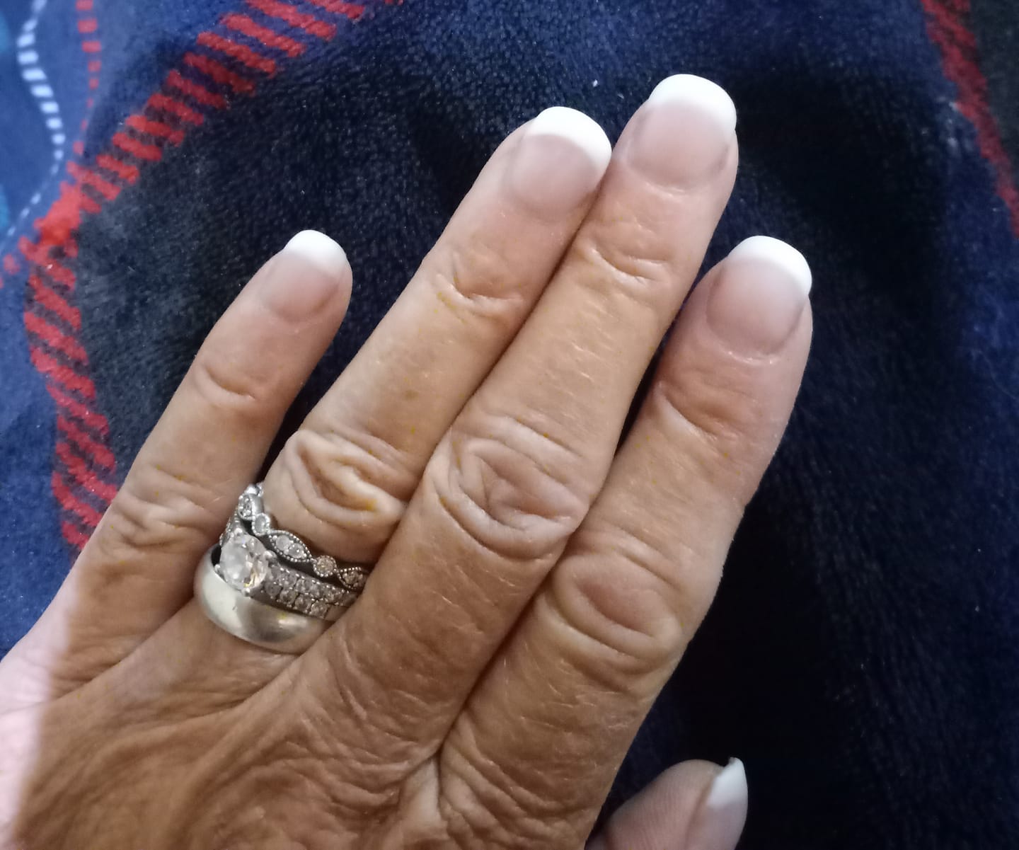 Customer photo review of Professional Sculptured Acrylic Nail Kit