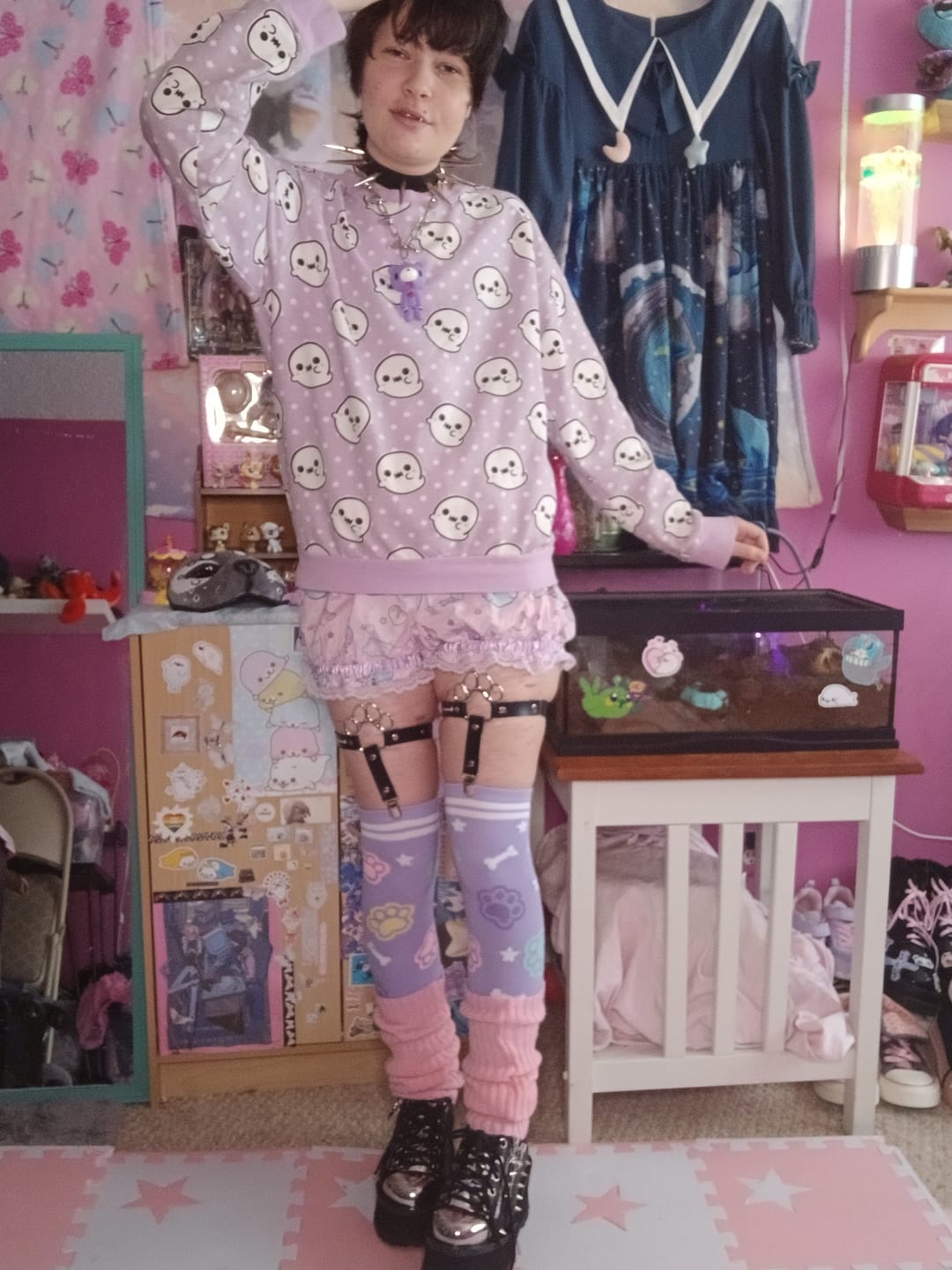 Customer photo review of ToeBeanies Black Sock Garters