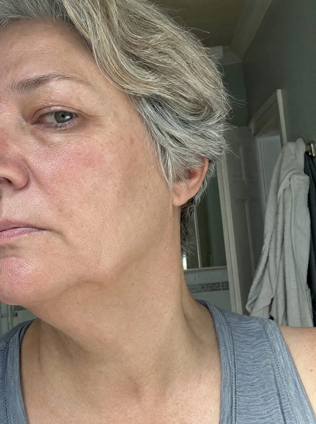 Customer photo review of Huile anti-repousse à la racine