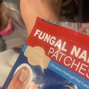 Customer photo review of Riparazione Notturna Unghie Cerotti Antifungini Extra Forte