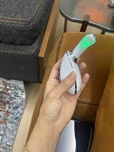Customer photo review of Veloura Porelift - Yüz ve Boyun Sıkılaştırma Cihazı