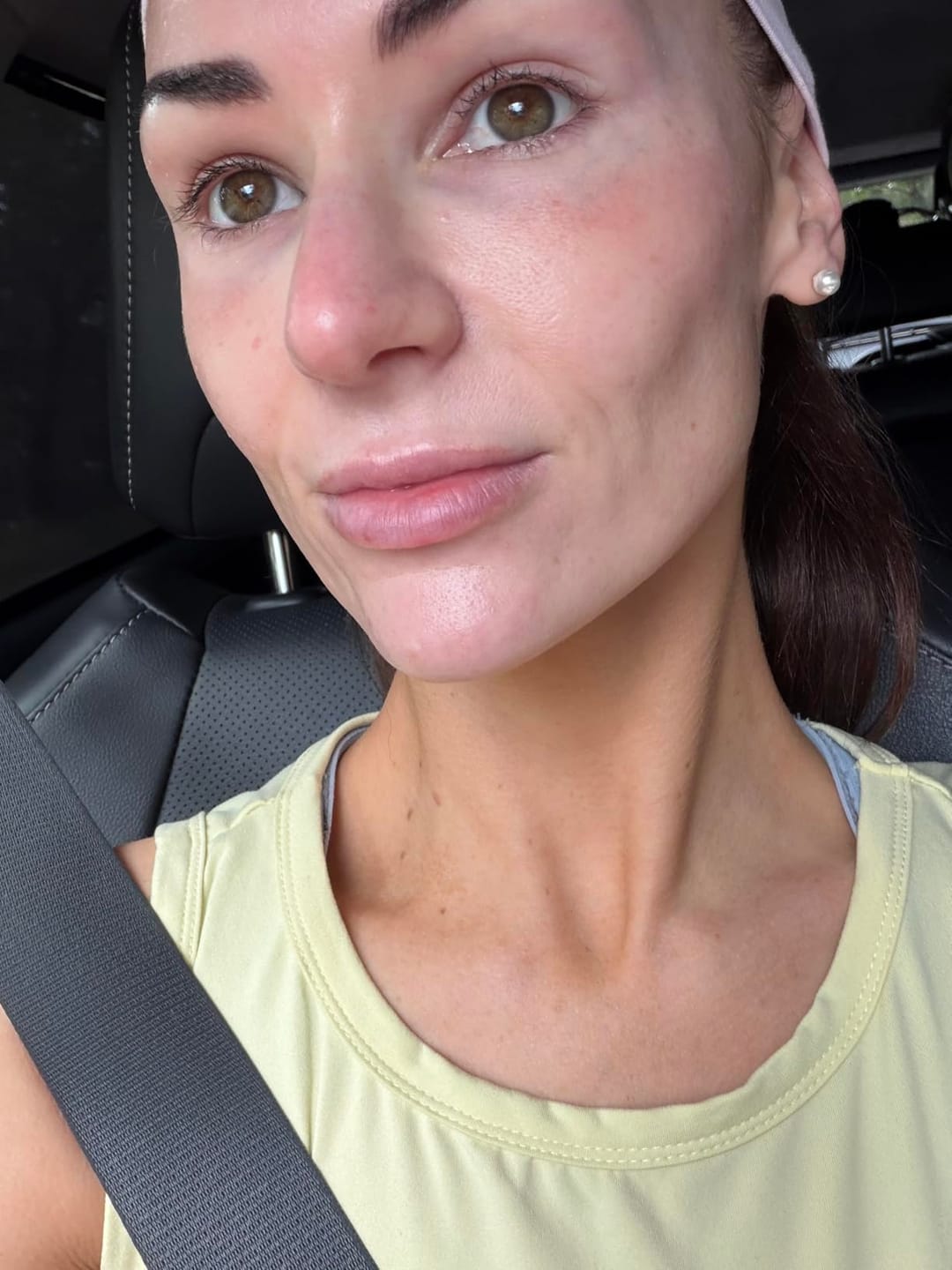 Customer photo review of Arvente Retinal Renewal™