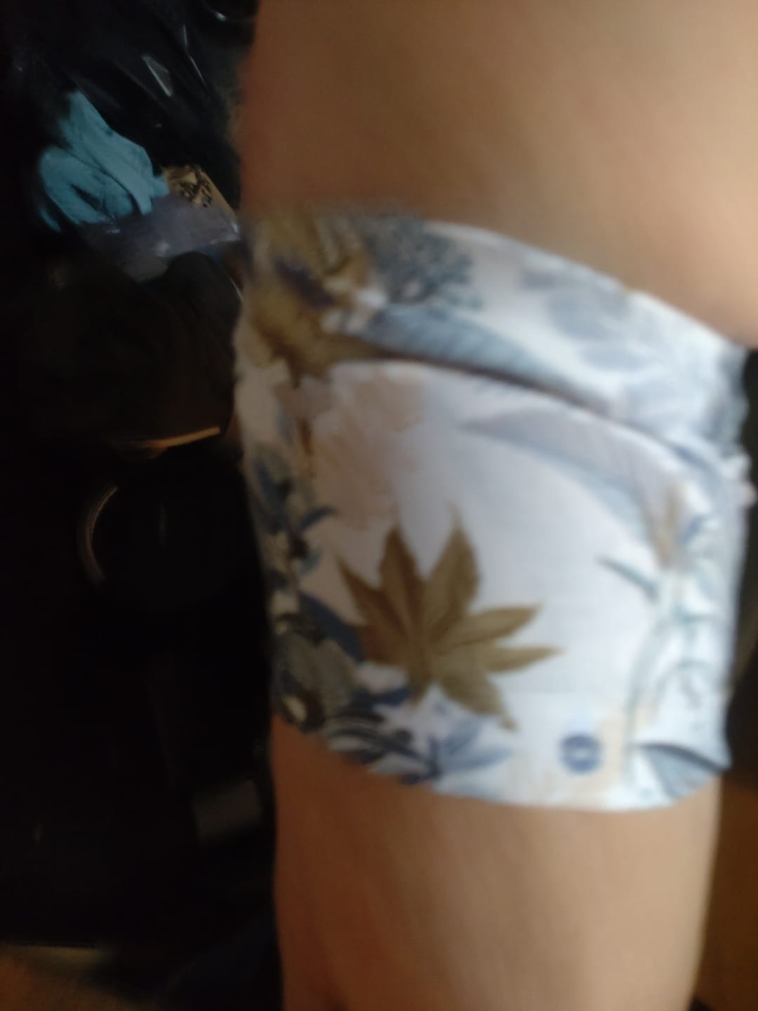 Customer photo review of Armband To Hold And Protect Your Glucose Sensor And Pod – Dia-Band ADULTS