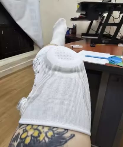 Customer photo review of VitaFlex™ Rodillera de Soporte y Alivio