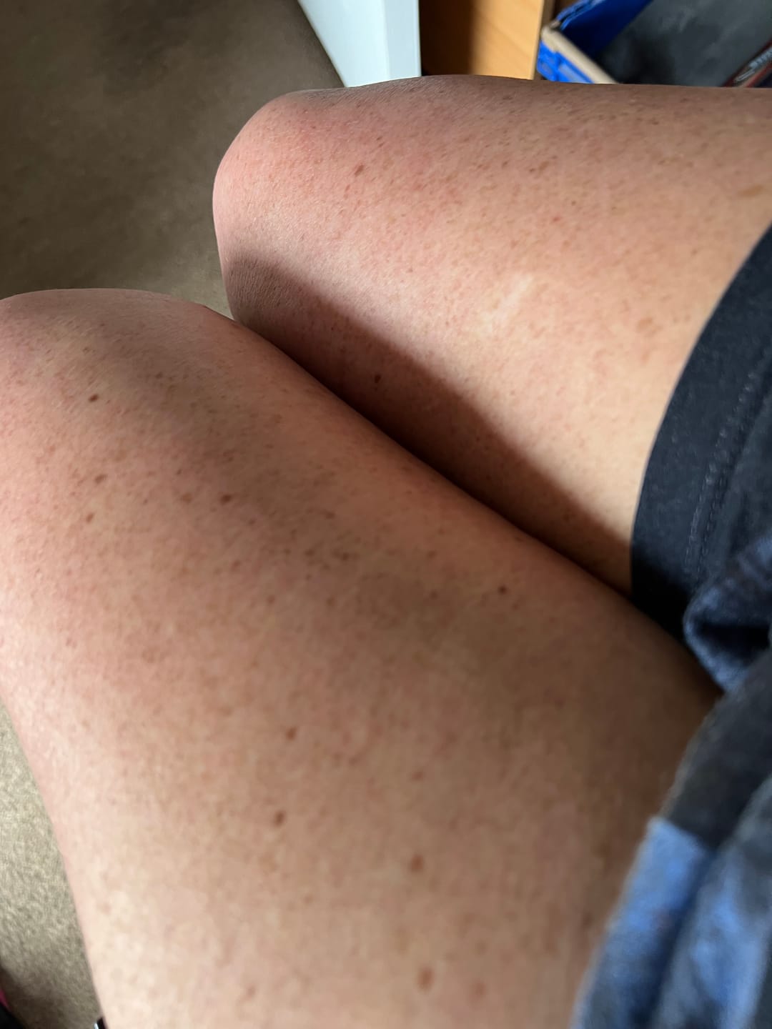 Customer photo review of Intensifying Tanning Cream - Coconut