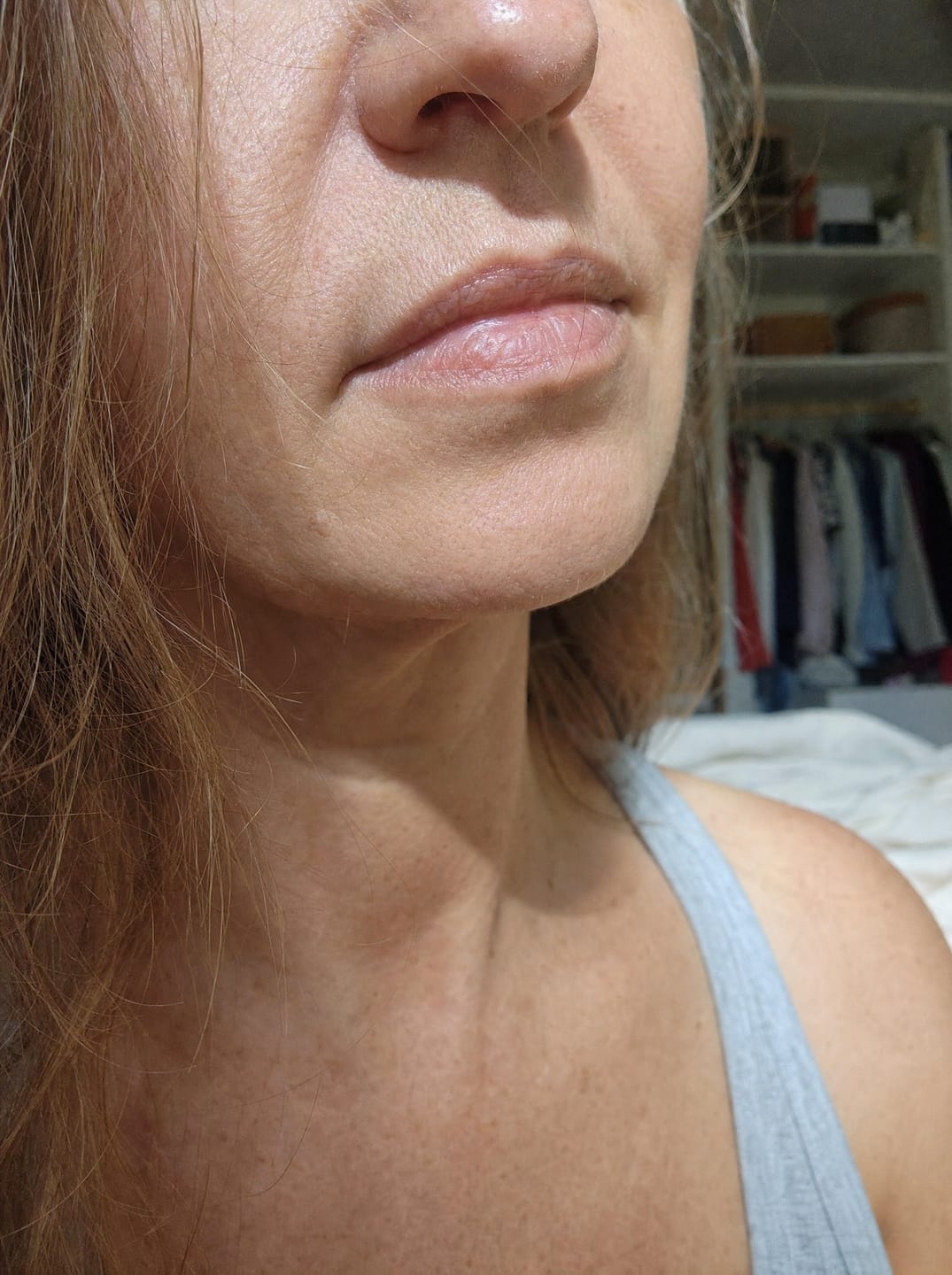 Customer photo review of Huile anti-repousse à la racine