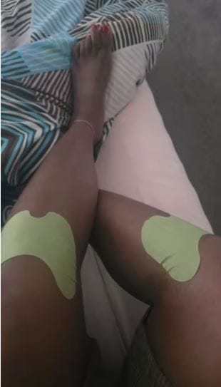 Customer photo review of RodiAlivio® | 50 parches para el dolor de rodilla