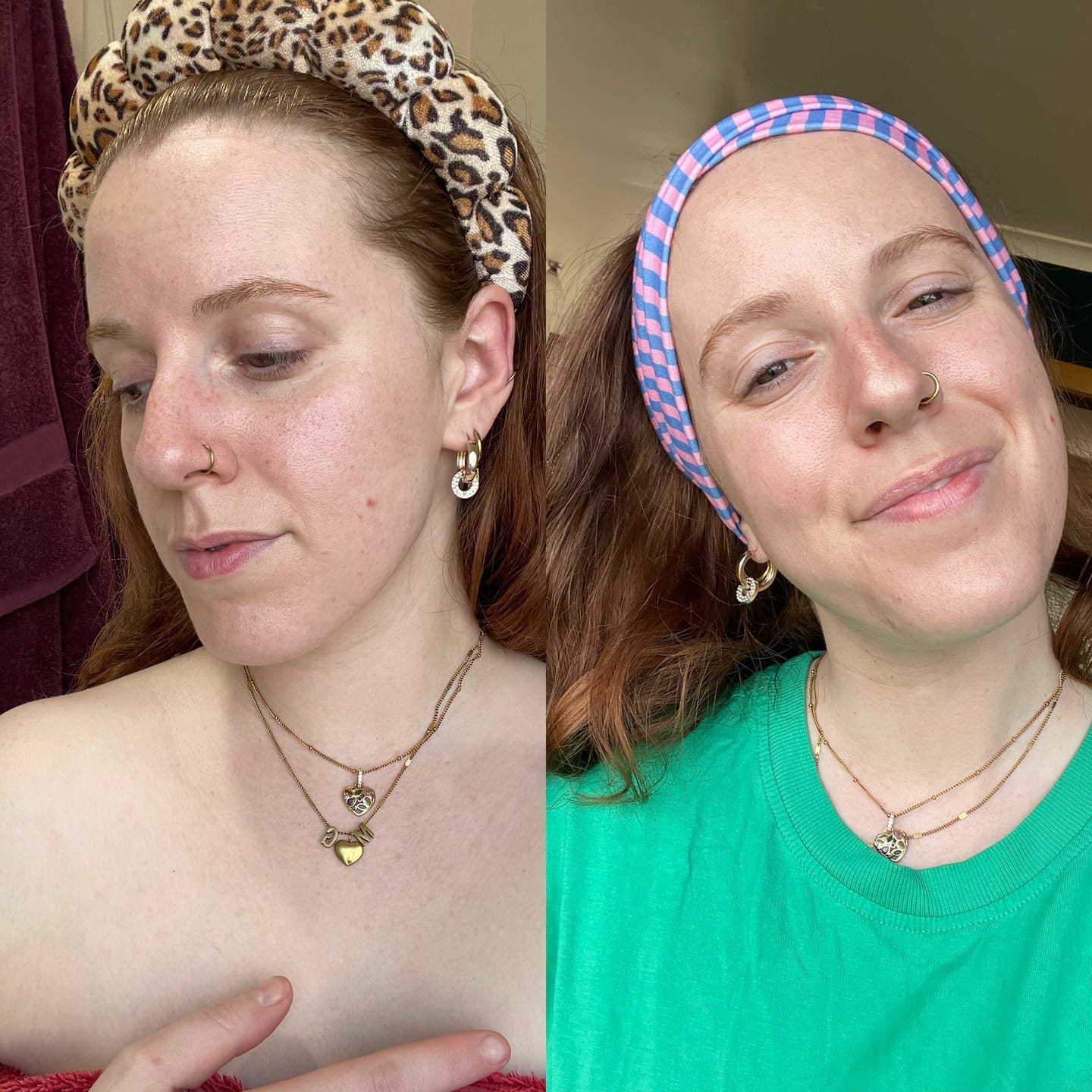 Customer photo review of SKIN-BOOSTING BRONZING DROPS