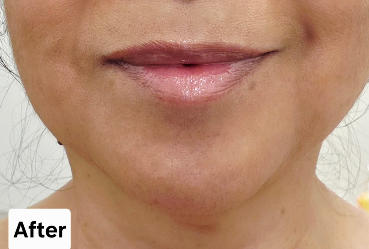 Customer photo review of Lip Serum