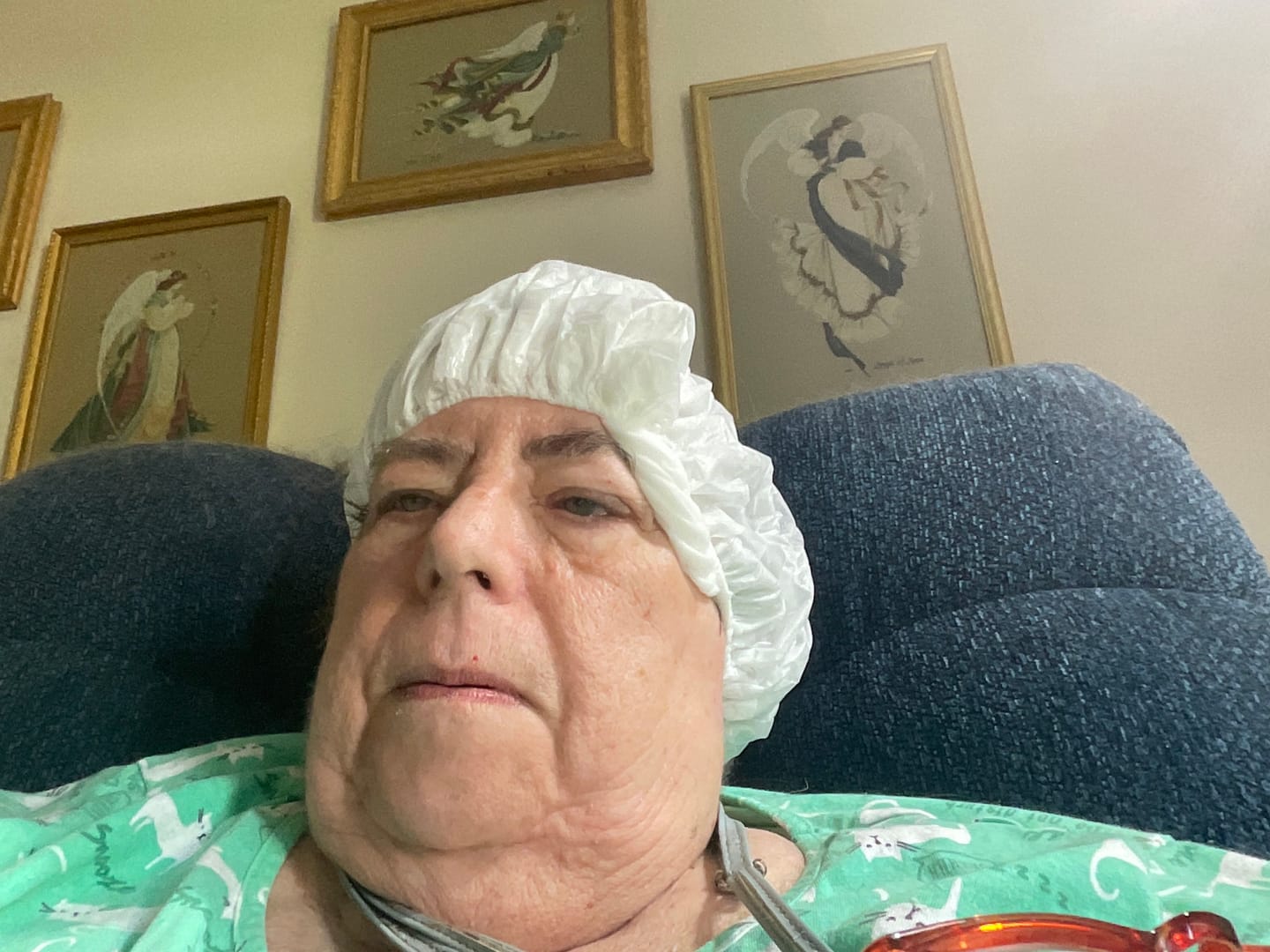 Customer photo review of Rinse Free Shampoo Cap