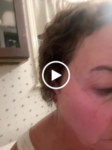 Customer video review of The Micro Infusion System™