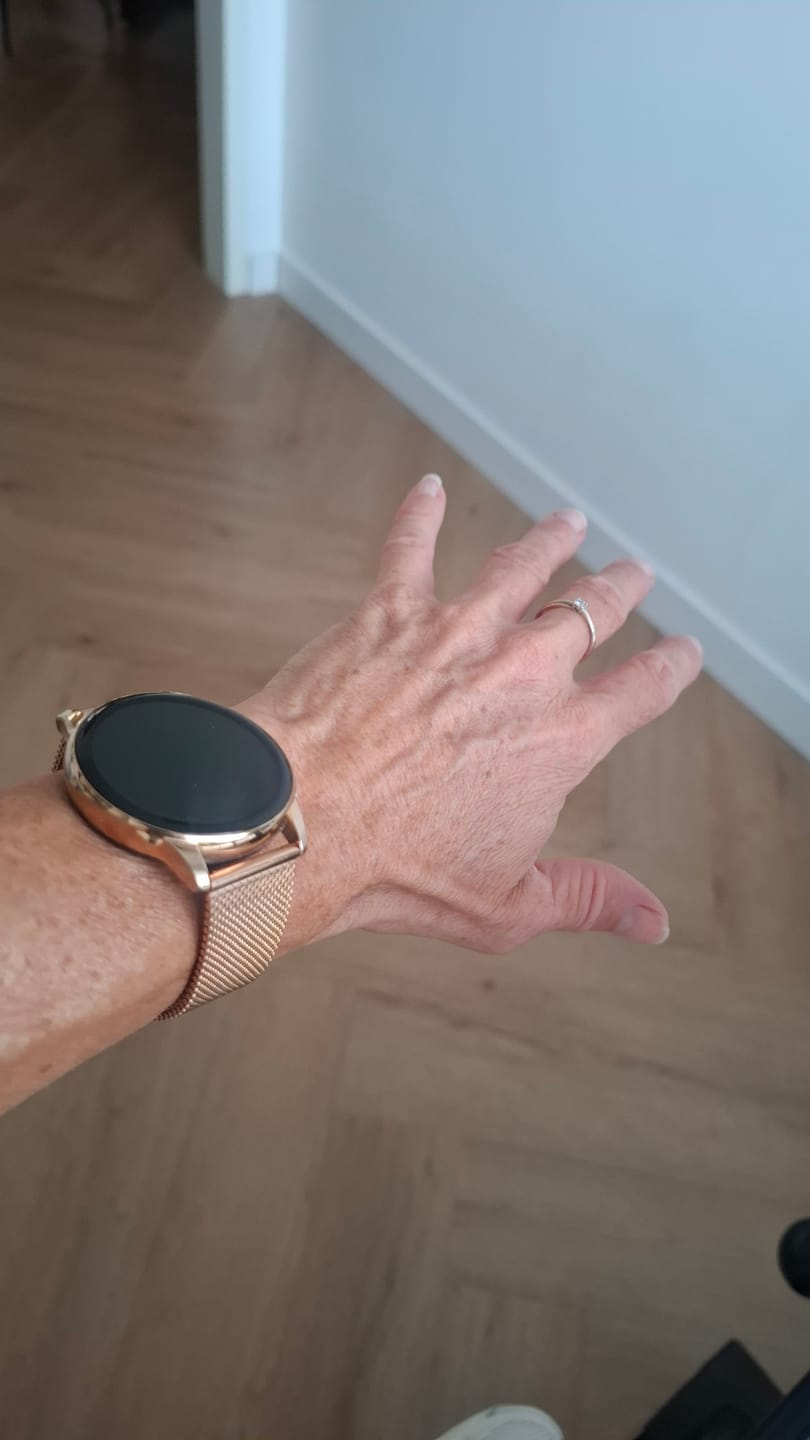 Customer photo review of Siltcon® Smartwatch Bandjes – Origineel Bandjes voor Auréa Smartwatch