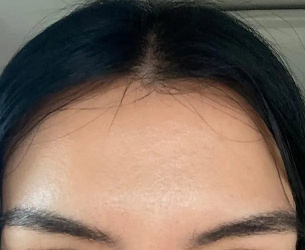 Customer photo review of Arvente Retinal Renewal™