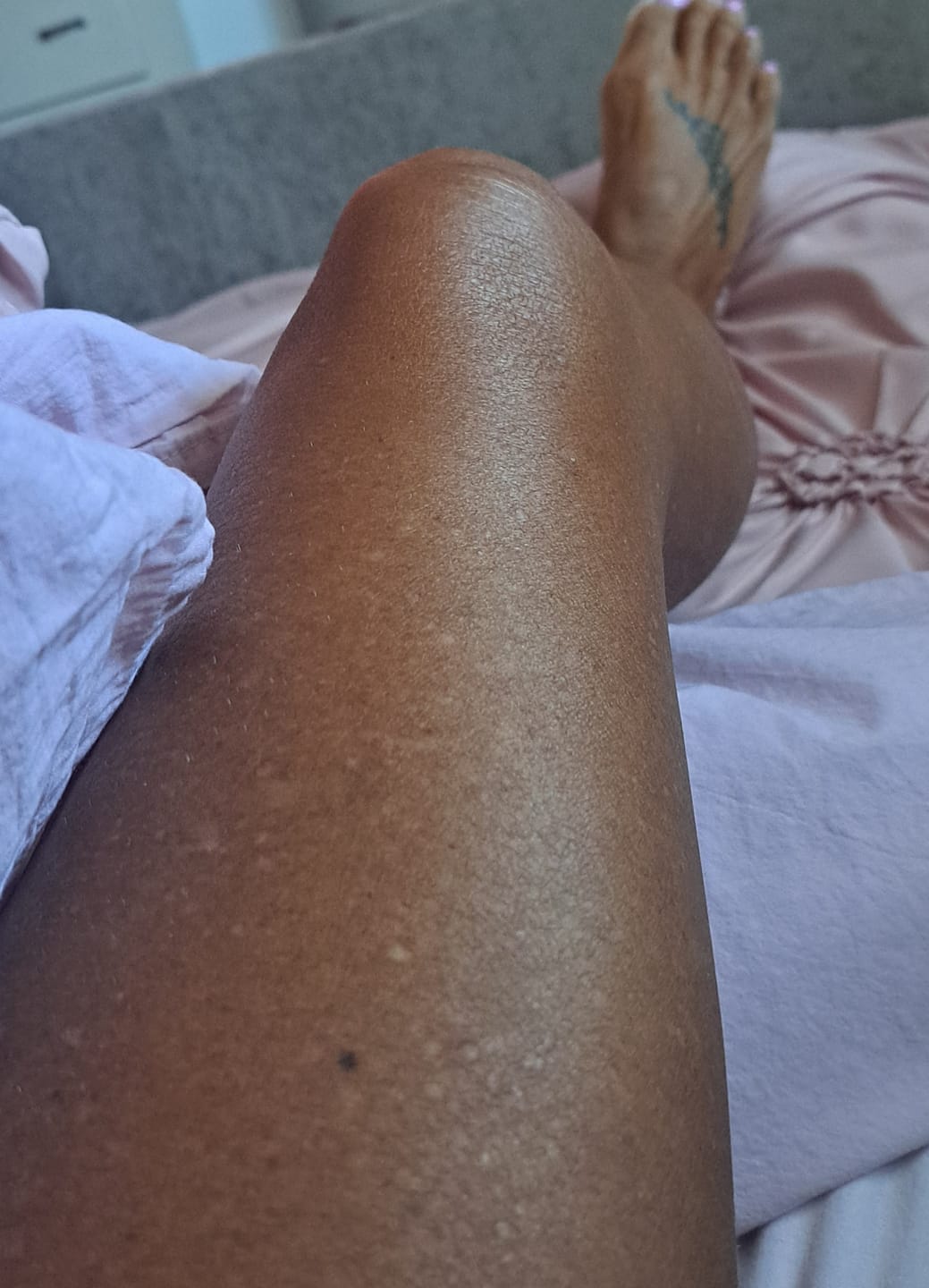 Customer photo review of Intensifying Tanning Gel - Watermelon