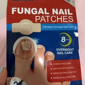 Customer photo review of Riparazione Notturna Unghie Cerotti Antifungini Extra Forte