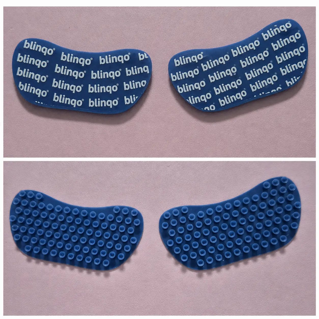 Customer photo review of Blinqo Supercharged Reusable Silicone Eye Masks