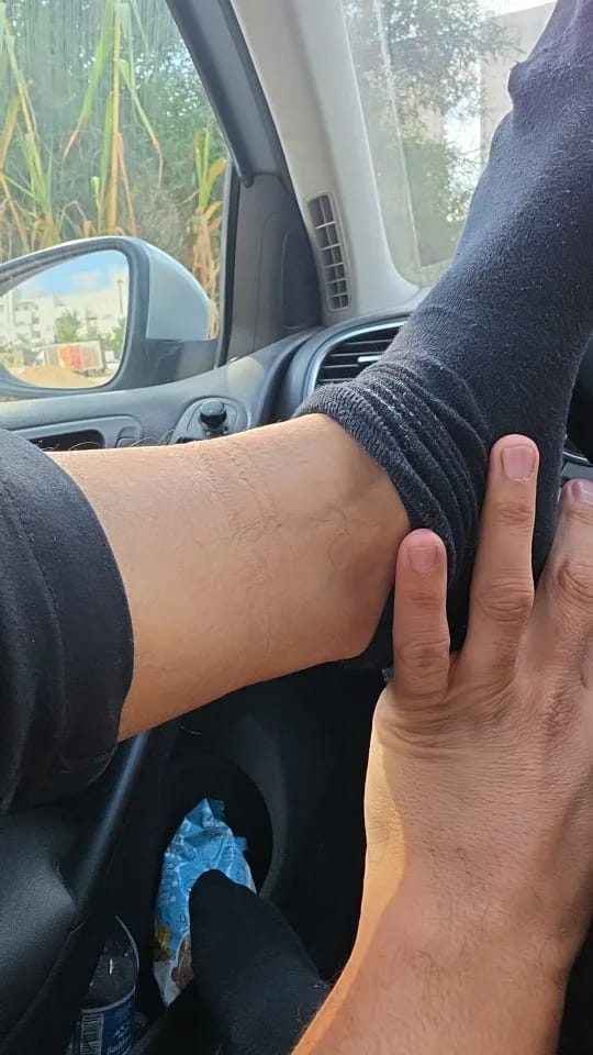 Customer photo review of Movagena HeatFlex Pro
