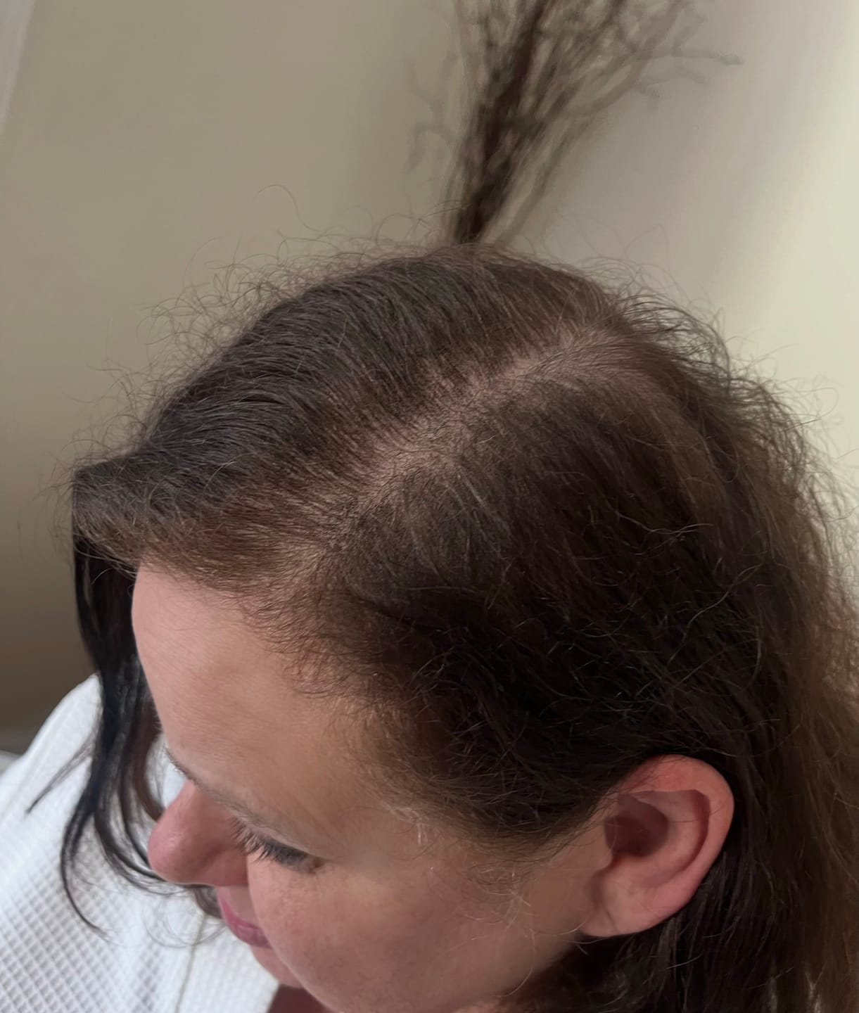 Customer photo review of Crown & Glory Vegan Hair Food Supplement
