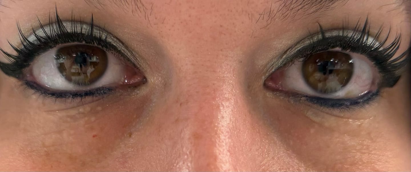 Customer photo review of Eyelash Curler